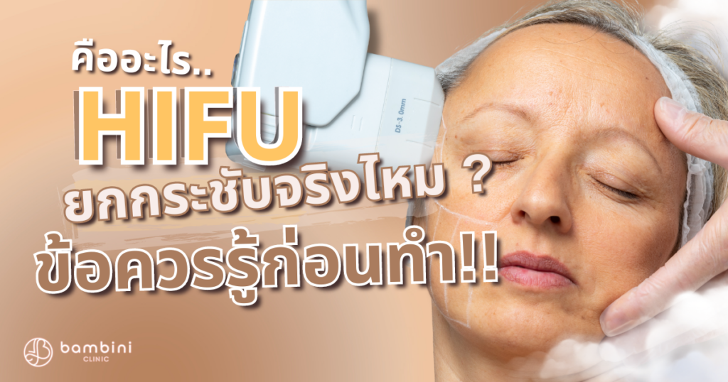 HIFU คืออะไร