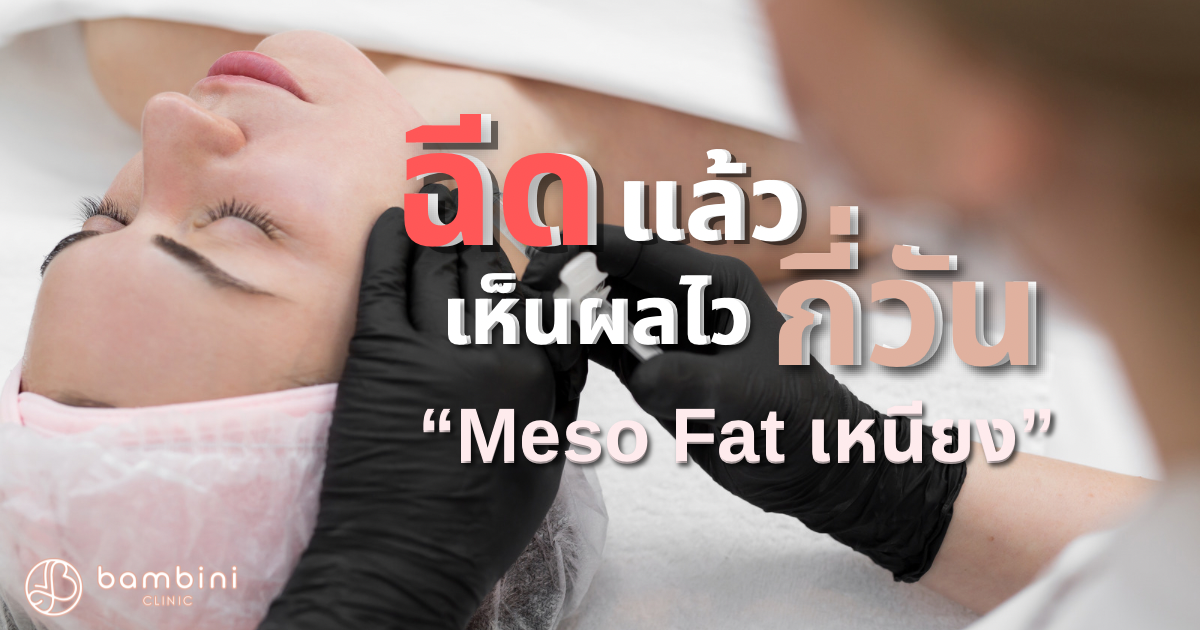 ฉีด Meso Fat กี่วันเห็นผล