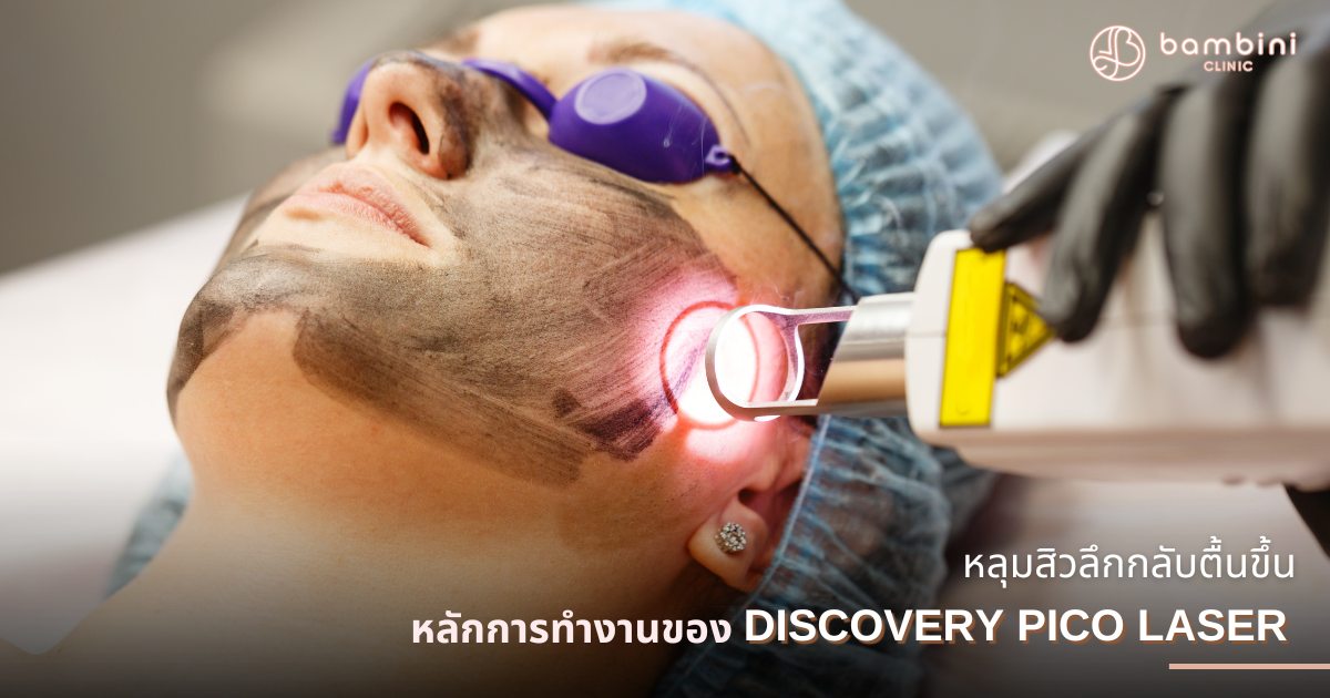 การทำงานของPico Laser