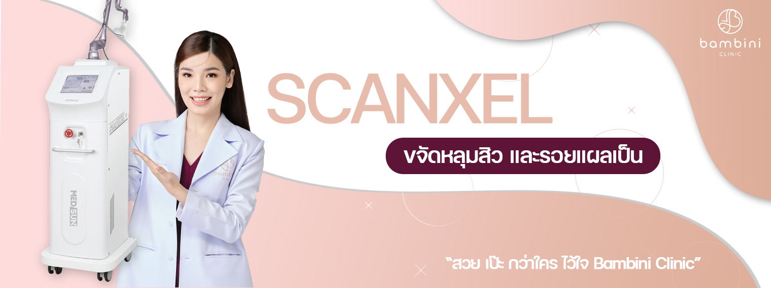 SCANXEL ขจัดหลุมสิว